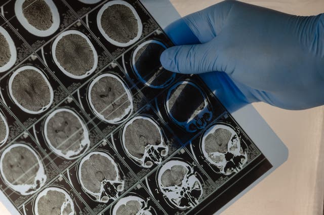 <p>Scientists have found the region of the brain responsible for a person’s ability to deal with new problems </p>