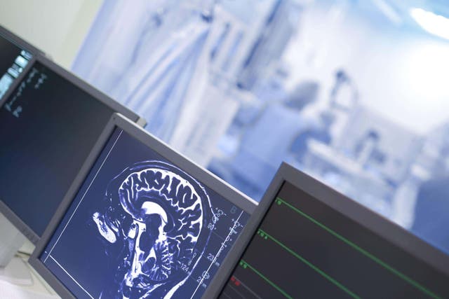 <p>Northern Scotland has one of the highest rates of Huntington’s disease globally, according to new research</p>