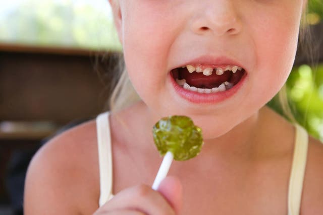 <p>A study has shown almost a third of five-year-olds are suffering from tooth decay</p>